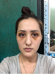photo-1 photo-1