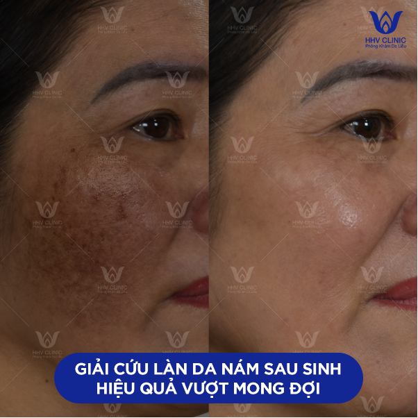 photo-1 photo-1