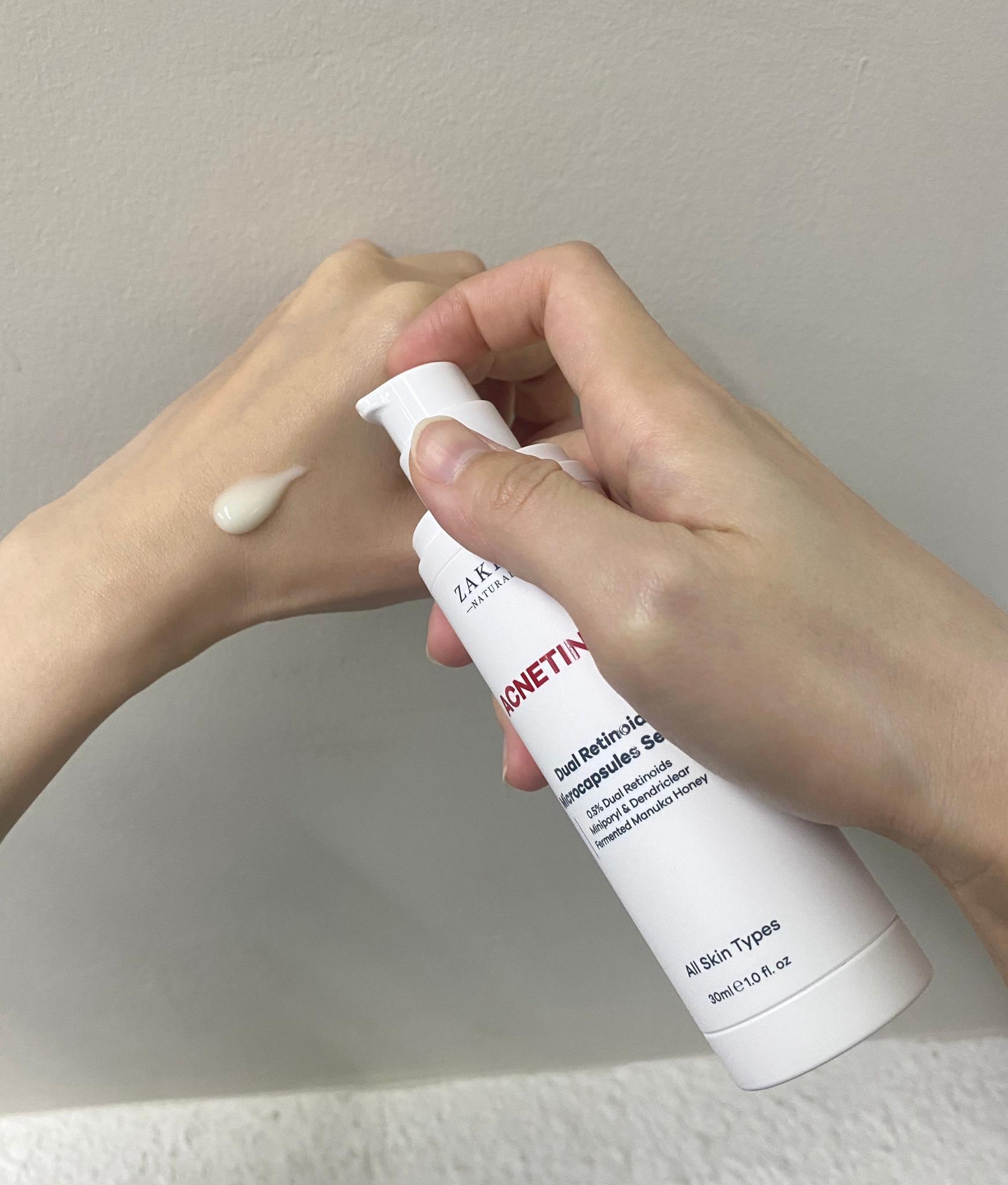 Chỉ sau 2 tuần "độ da", từ mụn ẩn thâm lâu hóa căng bóng đều màu - Bí kíp quen mà lạ!- Ảnh 2. Chỉ sau 2 tuần "độ da", từ mụn ẩn thâm lâu hóa căng bóng đều màu - Bí kíp quen mà lạ!- Ảnh 2.