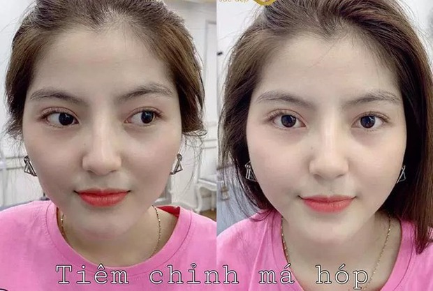 Hành trình nhan sắc của Chu Thanh Huyền: Càng yêu Quang Hải càng đẹp, thừa nhận “dao kéo” nhưng vẫn gây tranh cãi- Ảnh 6.