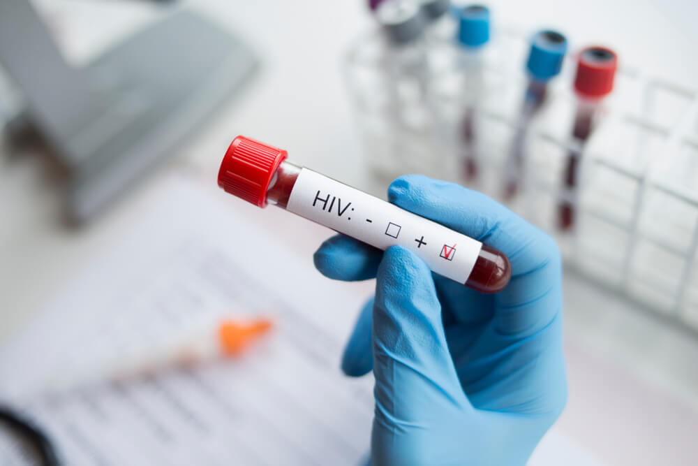 Vừa lên chức giám đốc, chàng trai được thông báo nhiễm HIV vì nguyên nhân không ngờ- Ảnh 3.