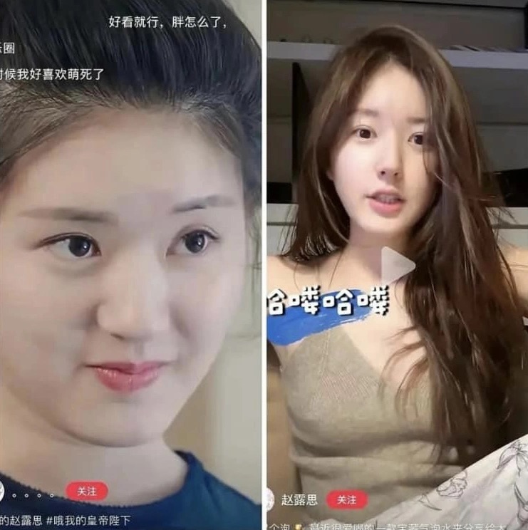 Loạt ảnh "đập tan" tin đồn thẩm mỹ của Triệu Lộ Tư khiến netizen phải thốt lên: Xinh từ bé- Ảnh 8.