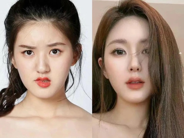 Loạt ảnh "đập tan" tin đồn thẩm mỹ của Triệu Lộ Tư khiến netizen phải thốt lên: Xinh từ bé- Ảnh 9.