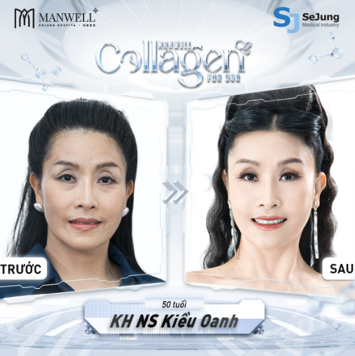 Bí mật đằng sau làn da trẻ trung bất ngờ của nghệ sĩ Kiều Oanh ở độ tuổi 50- Ảnh 3.