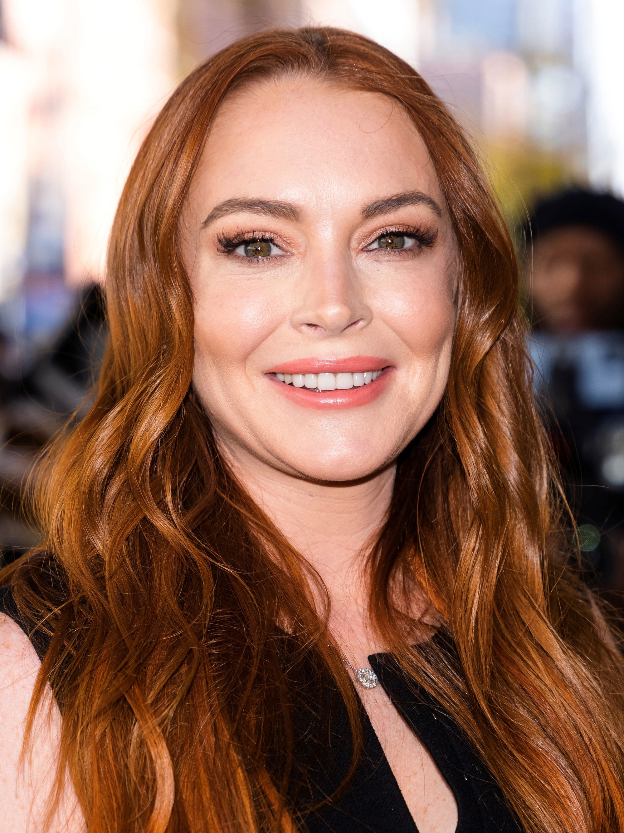 Bác sĩ thẩm mỹ nào có thể cứu vớt nhan sắc "cận date" như Lindsay Lohan cùng loạt sao Hollywood?- Ảnh 1.
