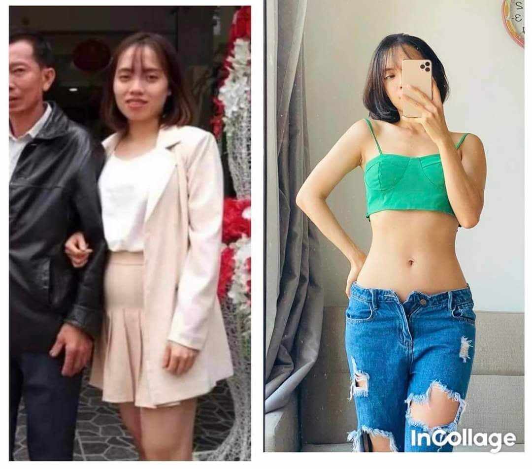 Vượt qua mặc cảm tự ti, cô gái niềng răng thay đổi diện mạo 180 độ, những thói quen hàng ngày cũng đáng học hỏi- Ảnh 7.