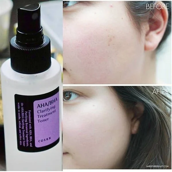 6 toner chứa BHA: Cứ bôi là da từ sần sùi, xỉn màu trở nên mướt rượt, căng bóng, nhan sắc lên hương từ đây- Ảnh 8.