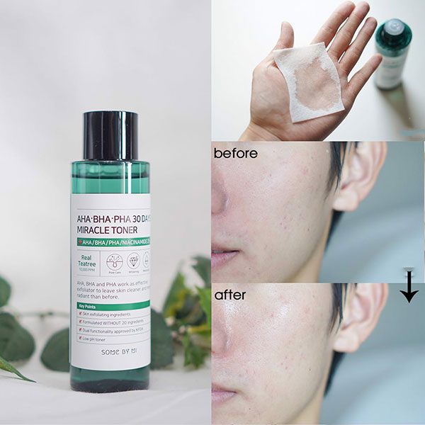 6 toner chứa BHA: Cứ bôi là da từ sần sùi, xỉn màu trở nên mướt rượt, căng bóng, nhan sắc lên hương từ đây- Ảnh 10.
