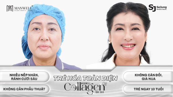 Nghệ sĩ Thanh Thủy: Thăng hạng nhan sắc tuổi trung niên vì chọn Manwell Collagen FDA 360- Ảnh 3.