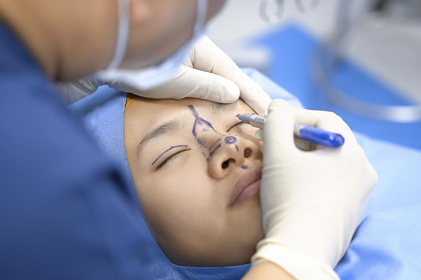 Cận cảnh quá trình can thiệp “dao kéo” của TikToker Xuân Ca tại thẩm mỹ Kangnam- Ảnh 4. Cận cảnh quá trình can thiệp “dao kéo” của TikToker Xuân Ca tại thẩm mỹ Kangnam- Ảnh 4.