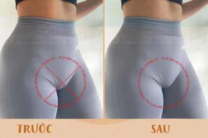 Món phụ kiện chị em nào cũng cần, thoải mái diện bikini, legging tập gym mà không lo "lộ hàng"- Ảnh 1. Món phụ kiện chị em nào cũng cần, thoải mái diện bikini, legging tập gym mà không lo "lộ hàng"- Ảnh 1.