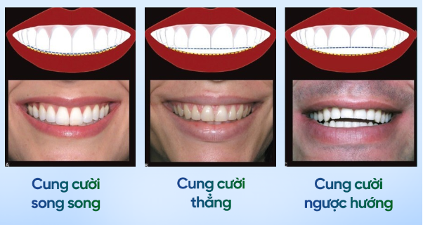 9 thông số tạo nên nụ cười đẹp không phải ai cũng biết- Ảnh 3.