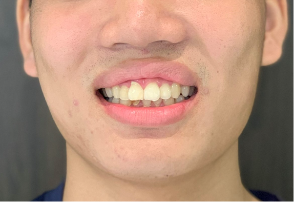 9 thông số tạo nên nụ cười đẹp không phải ai cũng biết- Ảnh 5.