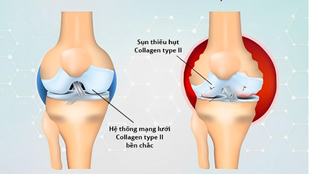 Vai trò của collagen đối với hệ cơ xương khớp- Ảnh 1.