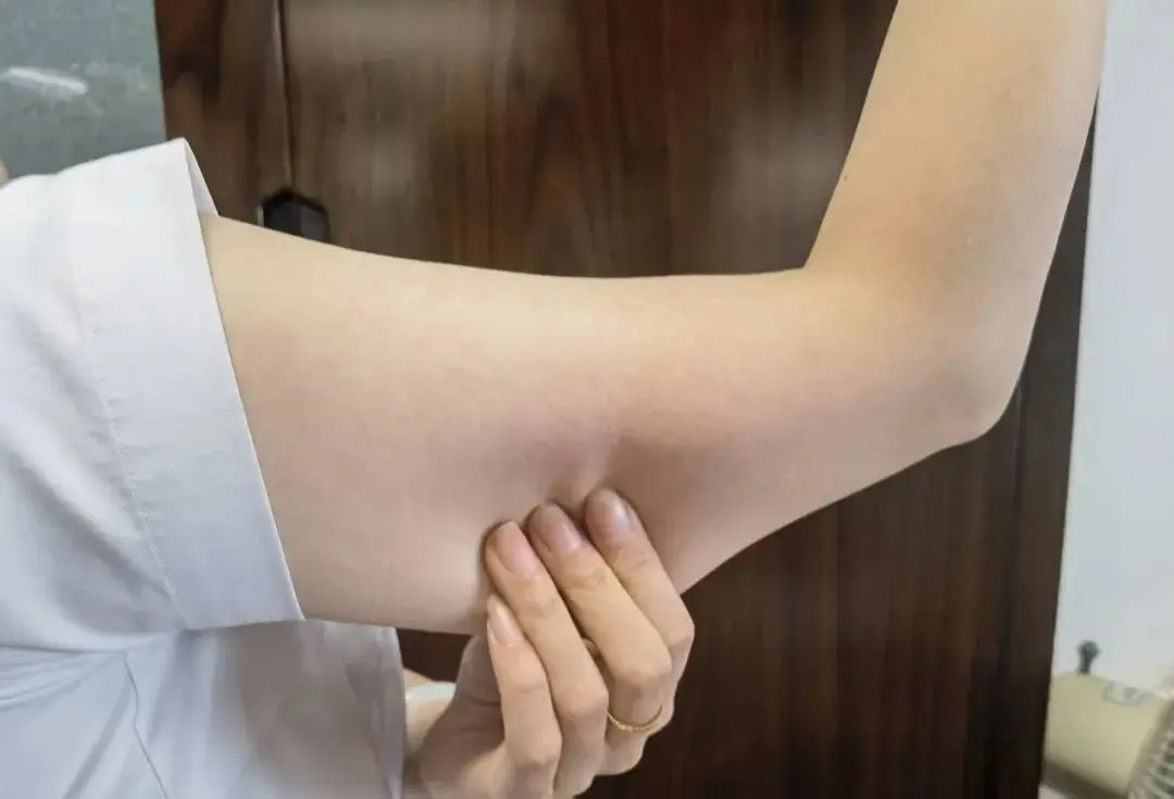 Dáng người mảnh mai, mềm mại này đáng sợ hơn cả người có mỡ thừa!- Ảnh 1. Dáng người mảnh mai, mềm mại này đáng sợ hơn cả người có mỡ thừa!- Ảnh 1.