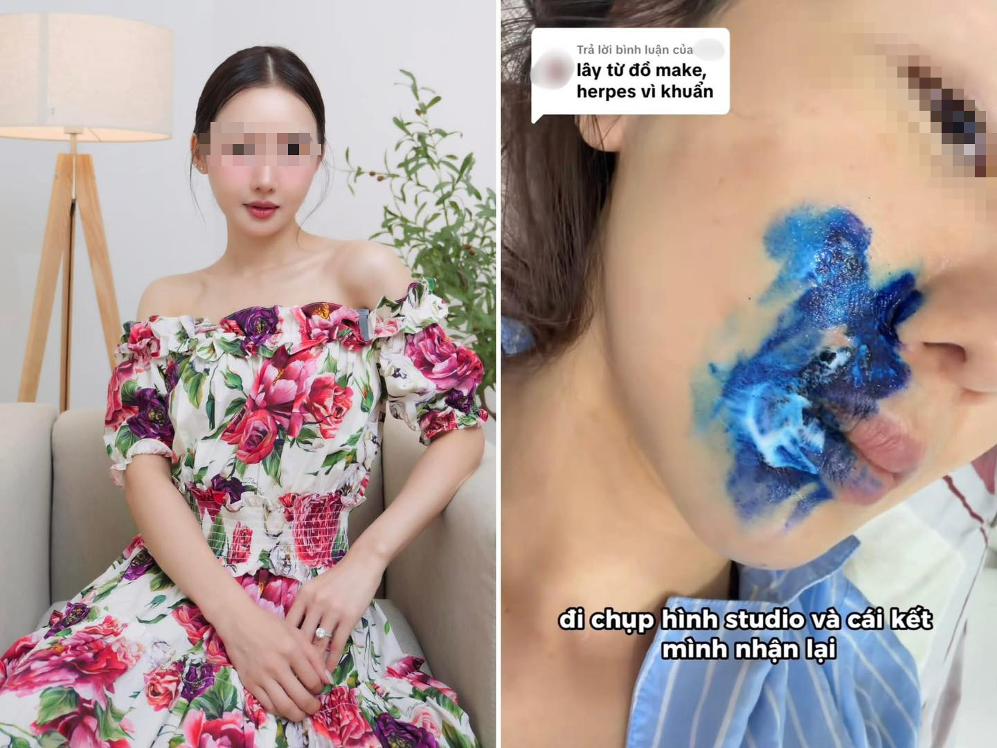 Chi 12 triệu chụp ảnh studio, cô gái khóc ròng vì bị lây virus Herpes: 1 món đồ quen thuộc bị tố cáo!- Ảnh 1.