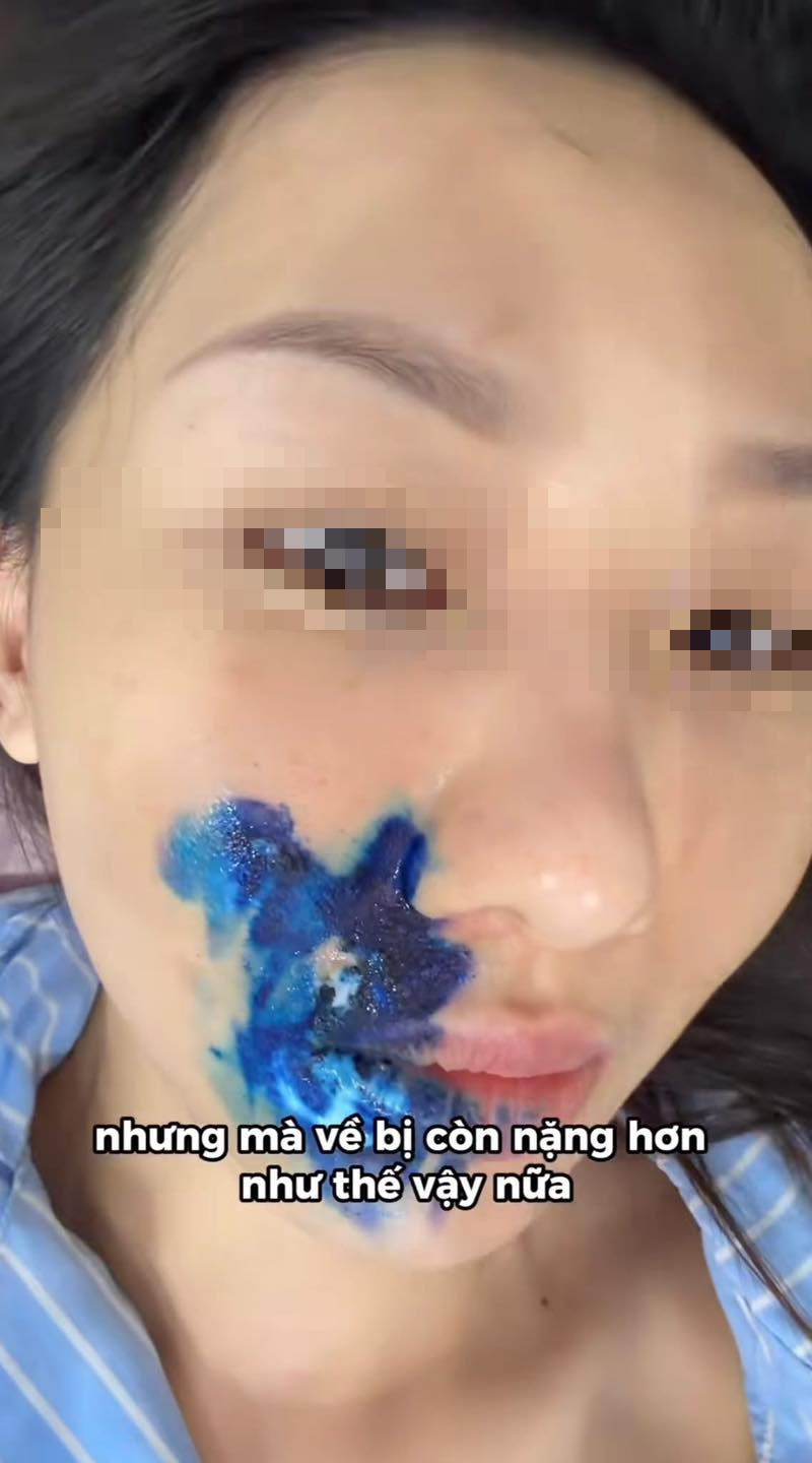 Chi 12 triệu chụp ảnh studio, cô gái khóc ròng vì bị lây virus Herpes: 1 món đồ quen thuộc bị tố cáo!- Ảnh 2.