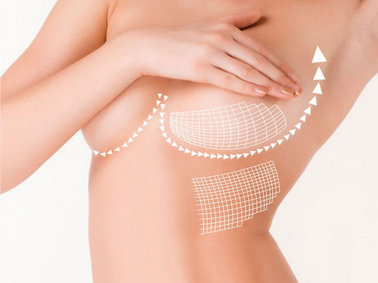 Tái tạo vú: Cuộc hồi sinh của người phụ nữ sau "vết sẹo vô hình"- Ảnh 2.