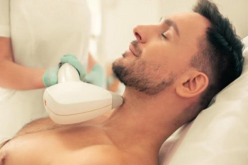 Triệt râu nam giới giá bao nhiêu? Gợi ý địa chỉ thực hiện uy tín- Ảnh 1. Triệt râu nam giới giá bao nhiêu? Gợi ý địa chỉ thực hiện uy tín- Ảnh 1.