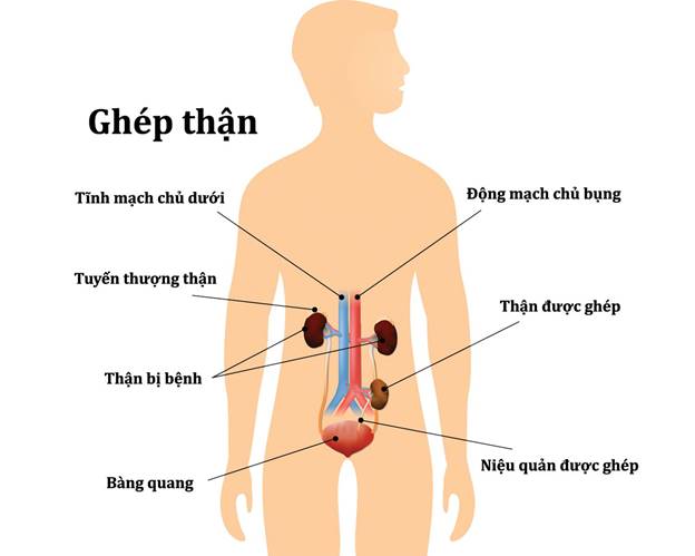 Người cha có phản ứng ngọt ngào khi biết người hiến thận cho mình là cô con gái 24 tuổi mà ông không nghĩ tới- Ảnh 4.