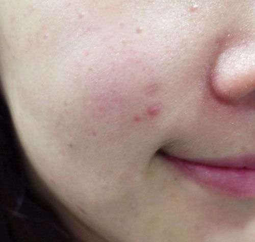 Da xỉn màu, nhợt nhạt đầu mùa lạnh: Đều do sai lầm hội U35 hay mắc- Ảnh 1.