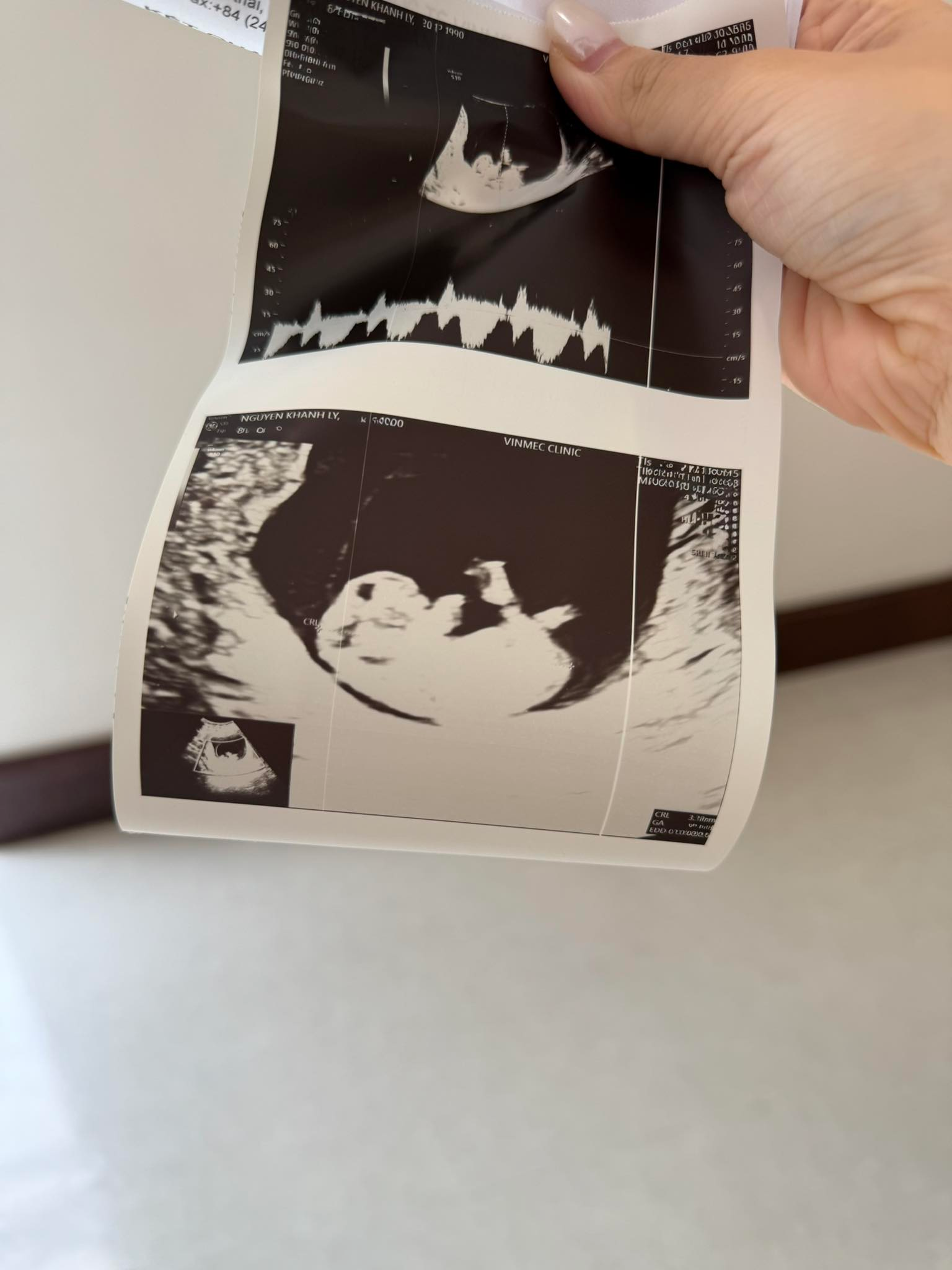 Hạnh phúc viên mãn: Hotmom Ly Kute khoe tin vui mang thai bé thứ 3- Ảnh 2.