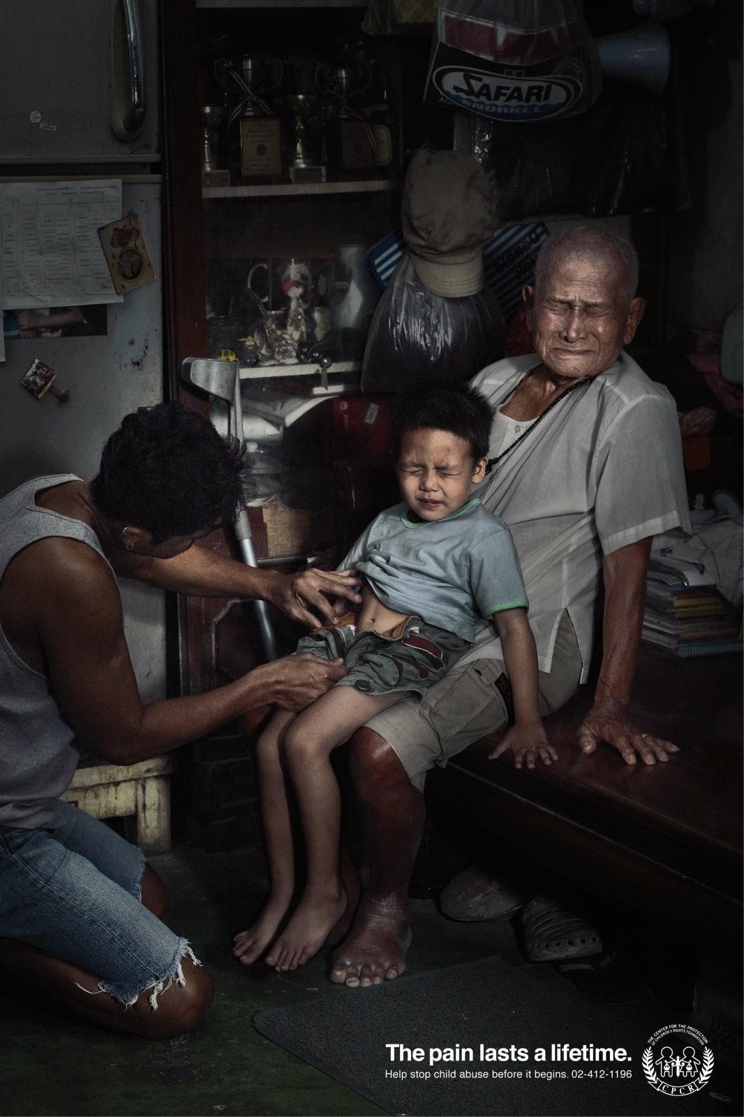 Bộ ảnh gây chấn động: "Nỗi đau theo suốt một đời"- Ảnh 2. Bộ ảnh gây chấn động: "Nỗi đau theo suốt một đời"- Ảnh 2.