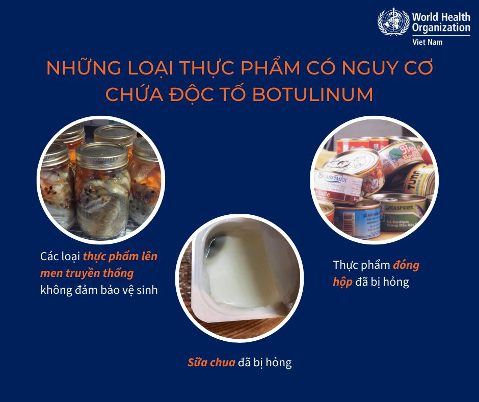 Ngộ độc botulinum: Mối nguy từ vi khuẩn “vô hình” trong thực phẩm và lời cảnh tỉnh từ vụ sữa nhiễm khuẩn- Ảnh 4.