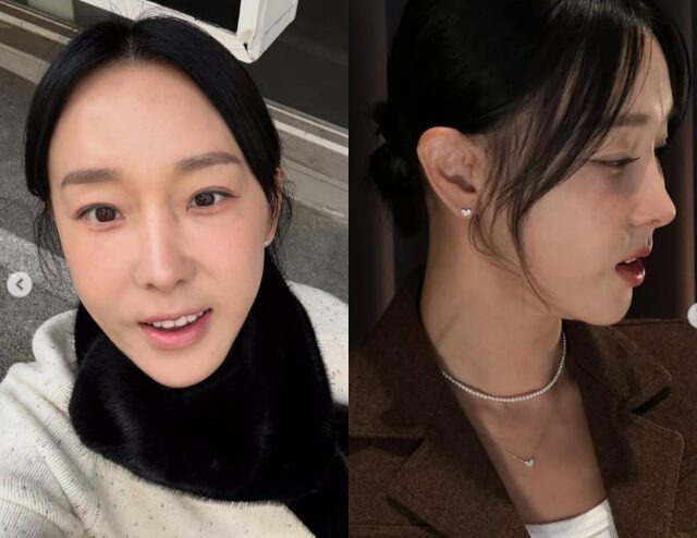 Mỹ nhân phim giờ vàng liều lĩnh "dao kéo" thu ngắn nhân trung, giờ gánh di chứng đến suốt đời- Ảnh 1. Mỹ nhân phim giờ vàng liều lĩnh "dao kéo" thu ngắn nhân trung, giờ gánh di chứng đến suốt đời- Ảnh 1.