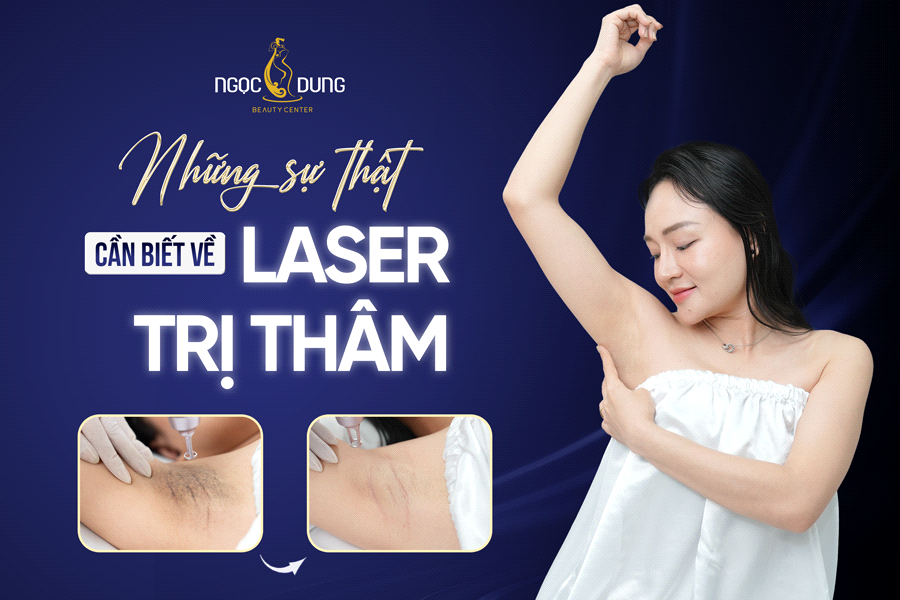 Sự thật về laser trị thâm: Điều bạn cần biết trước khi điều trị- Ảnh 1. Sự thật về laser trị thâm: Điều bạn cần biết trước khi điều trị- Ảnh 1.