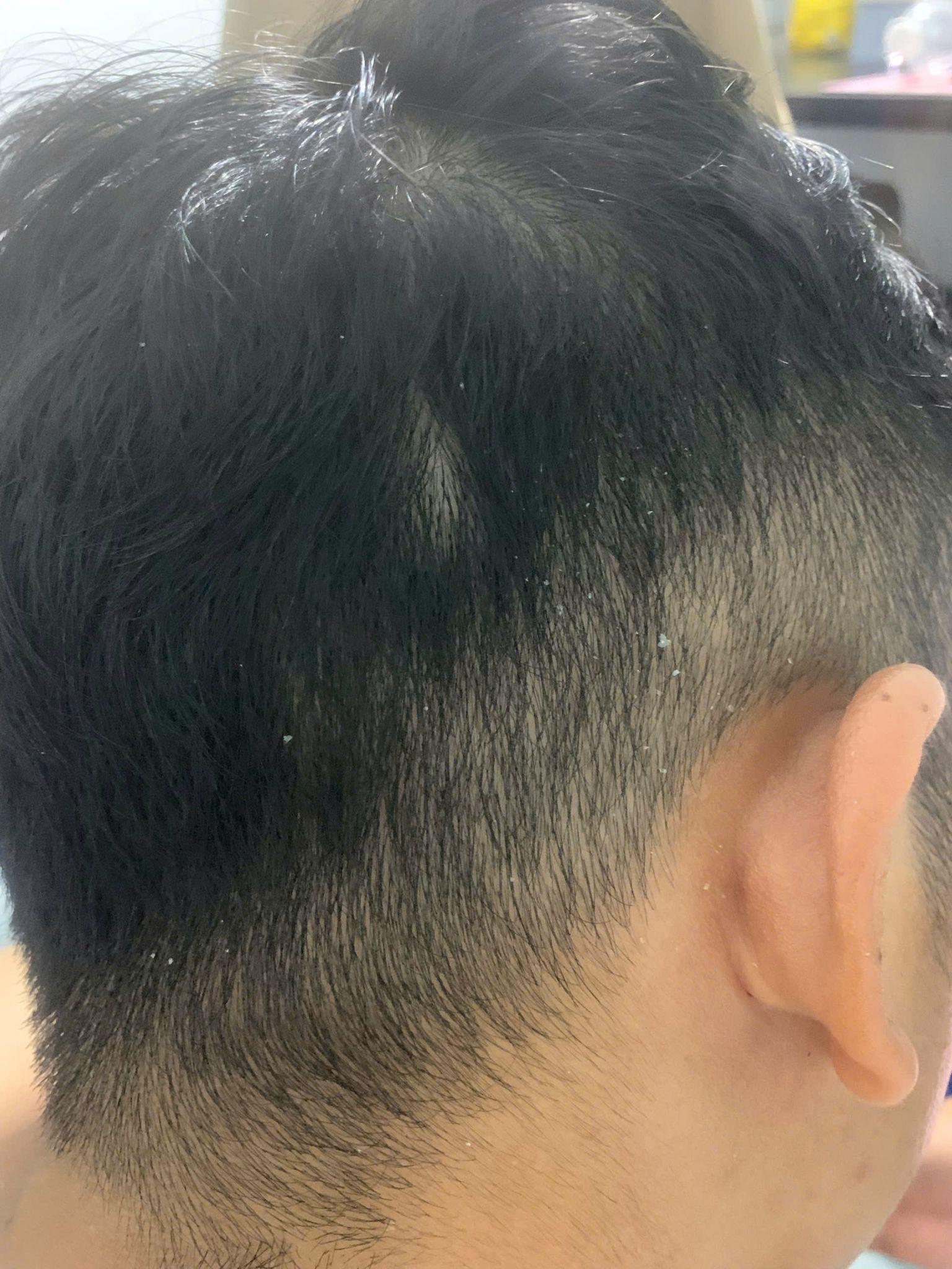 Antisol – bước tiến mới trong xu hướng dầu gội dược liệu sạch gàu- Ảnh 3. Antisol – bước tiến mới trong xu hướng dầu gội dược liệu sạch gàu- Ảnh 3.