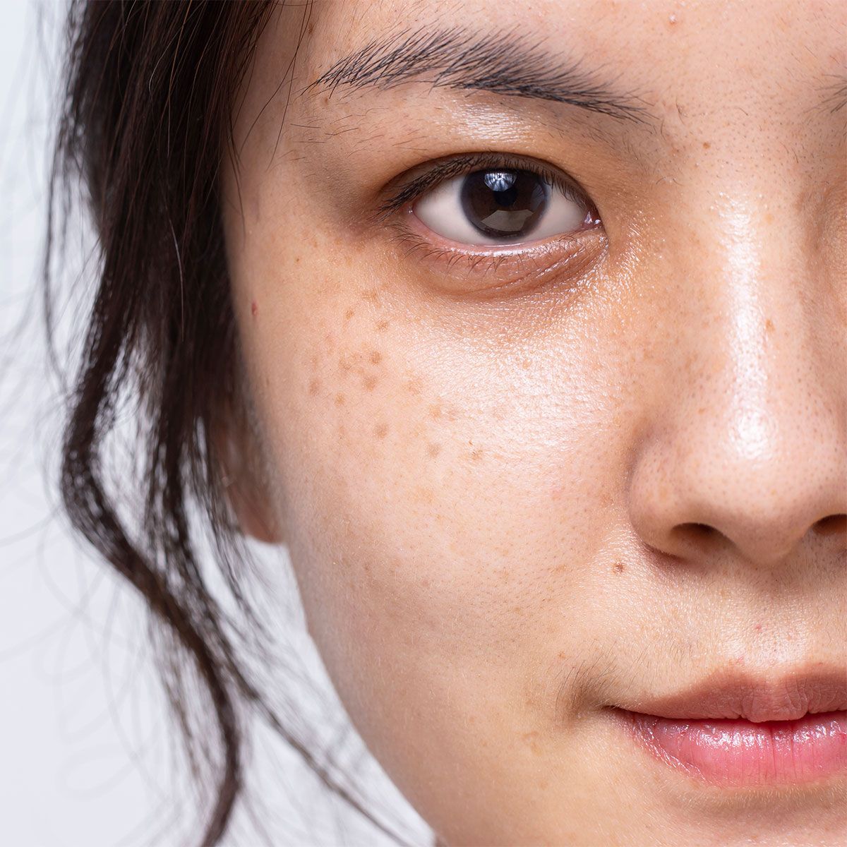 Trị nám tuổi 40 không hề khó nếu bạn bổ sung 2 dưỡng chất này mỗi ngày, phụ nữ trung niên càng nên áp dụng - Ảnh 1.