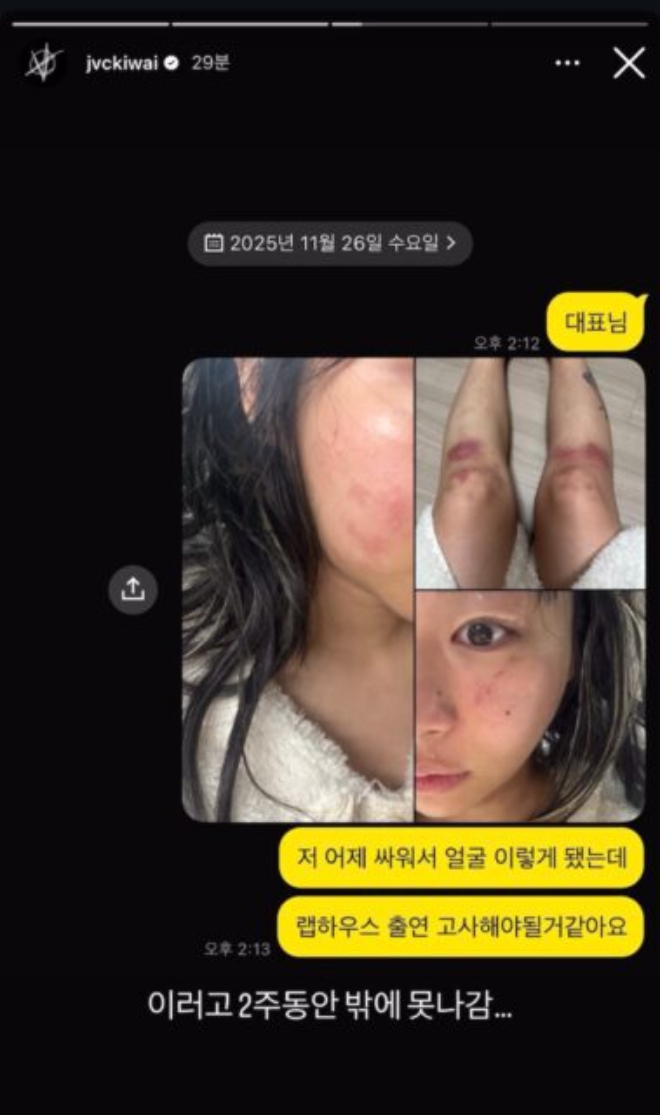 Nữ rapper 96 tung ảnh bị bạn trai đánh bầm dập đến mức hủy show, đàng trai hùng hổ phốt ngược gây phẫn nộ- Ảnh 2. Nữ rapper 96 tung ảnh bị bạn trai đánh bầm dập đến mức hủy show, đàng trai hùng hổ phốt ngược gây phẫn nộ- Ảnh 2.