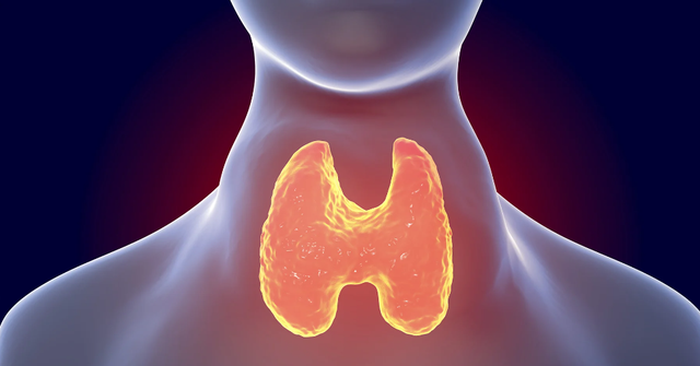 Sinh viên Đại học Bách khoa năm cuối bị basedow nhiều năm, bác sĩ hỏi vẫn không biết mình mắc bệnh gì- Ảnh 3. Sinh viên Đại học Bách khoa năm cuối bị basedow nhiều năm, bác sĩ hỏi vẫn không biết mình mắc bệnh gì- Ảnh 3.