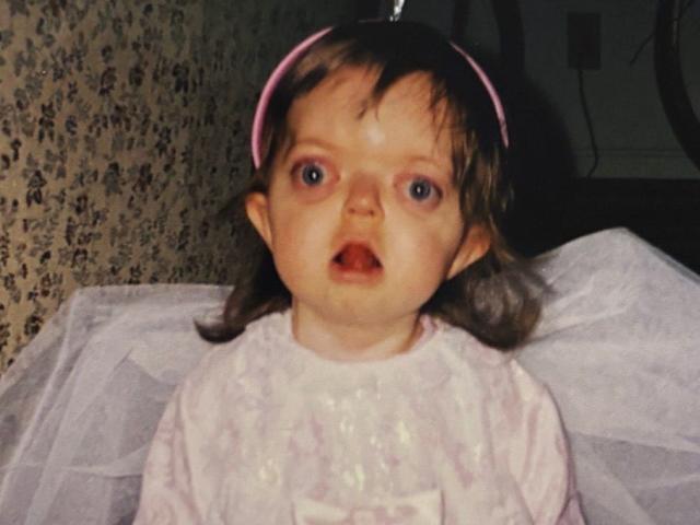 Tôi đã che giấu khuôn mặt suốt nhiều năm, nhưng giờ tôi tự hào chấp nhận vẻ khác biệt của chính mình- Ảnh 2. Tôi đã che giấu khuôn mặt suốt nhiều năm, nhưng giờ tôi tự hào chấp nhận vẻ khác biệt của chính mình- Ảnh 2.