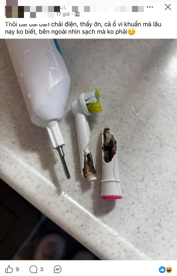 Cận cảnh thứ bên trong của bàn chải điện khiến nhiều người rùng mình: BS nói gì?- Ảnh 1.