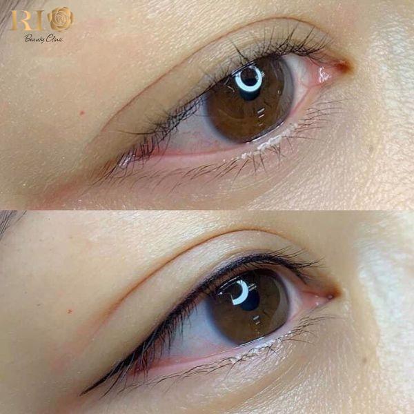 Phun mí Glamor tạo điểm nhấn cho đôi mắt tại Thẩm Mỹ Rio- Ảnh 1.