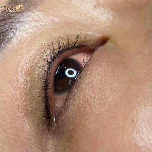 Phun mí Glamor tạo điểm nhấn cho đôi mắt tại Thẩm Mỹ Rio- Ảnh 2.