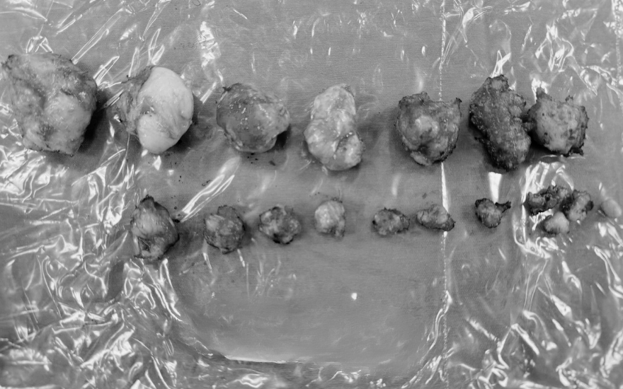 Ảnh 3 - Đã chỉnh theo fb của BBT