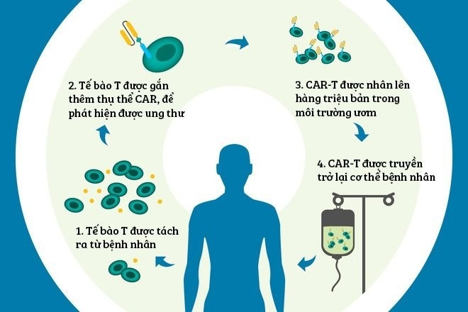 Bệnh ung thư máu bé Bắp mắc phải: Chi phí "khổng lồ" khi điều trị ở Singapore, ở Việt Nam có tiết kiệm hơn?- Ảnh 3.