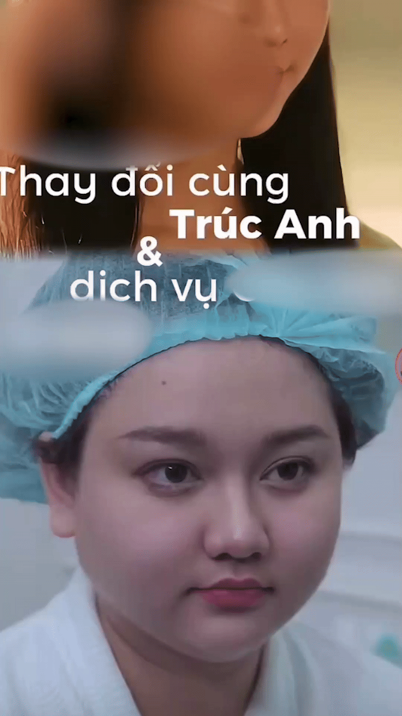 Trúc Anh (Mắt Biếc) phẫu thuật thẩm mỹ?- Ảnh 1.