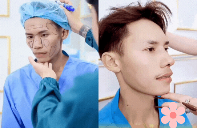 Diện mạo mới của chàng trai hot nhất Nam vương Campuchia sau khi “dao kéo” toàn bộ gương mặt ở Việt Nam- Ảnh 5.