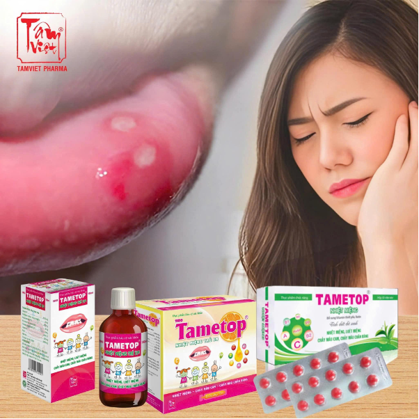 Top sai lầm khi điều trị nhiệt miệng khiến vết loét lâu lành- Ảnh 4.