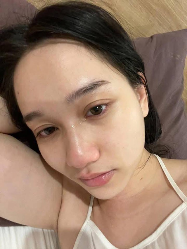 Hình ảnh mới nhất gây bất ngờ của Trúc Anh (Mắt Biếc) hậu nâng cơ mặt- Ảnh 5.