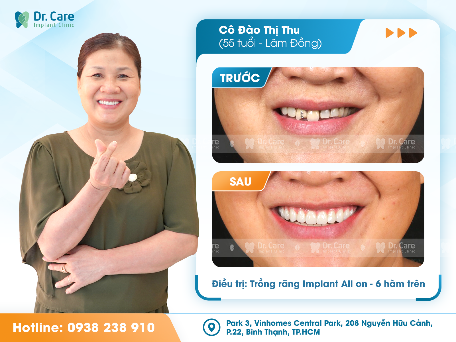 Trồng răng implant toàn hàm tuổi trung niên: Đừng chọn sai nha khoa- Ảnh 2.