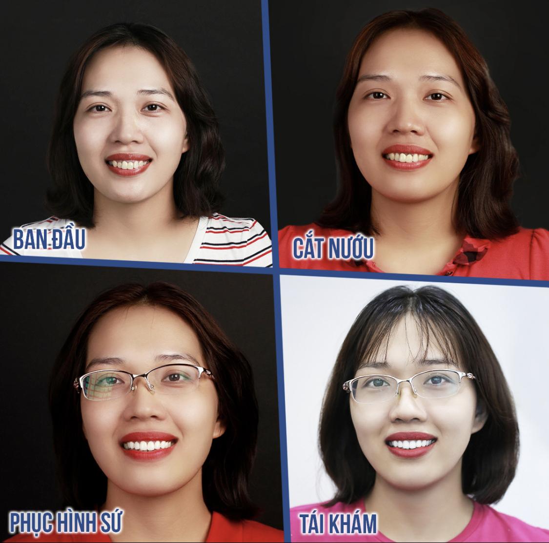 Người "cứu tinh" của những nụ cười: "Sửa răng sứ hỏng" cũng cần cả trái tim- Ảnh 2.