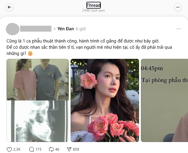 Yên Đan - “công chúa của SOOBIN”: Ngỡ ngàng diện mạo trước khi phẫu thuật - Ảnh 5.
