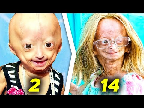 Những đứa trẻ có "tuổi thơ bị rút ngắn" và câu chuyện lão hóa ngay khi còn là trẻ con- Ảnh 4.