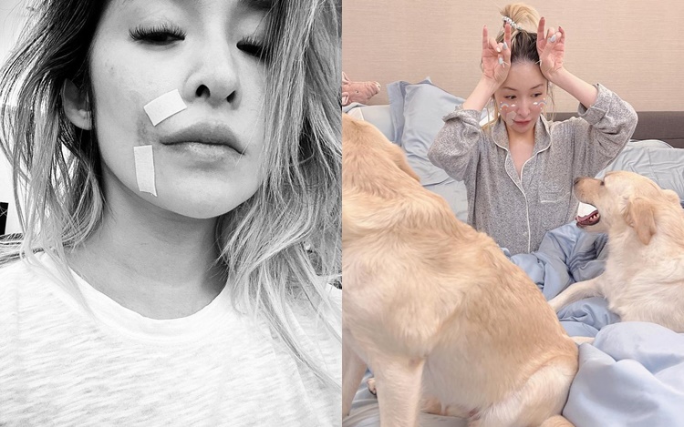 Sốc nặng với "gương mặt rắn" biến dạng của nữ ca sĩ hạng A sau vụ bị chó cắn đến hủy dung- Ảnh 5.