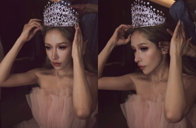 Sốc nặng với "gương mặt rắn" biến dạng của nữ ca sĩ hạng A sau vụ bị chó cắn đến hủy dung- Ảnh 1.